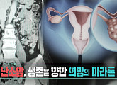 '생로병사의 비밀' 조기 발견 어려운 난소암