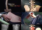 '명의' 김영훈 교수가 전하는 척추수술 후 실패증후군 및 치료법