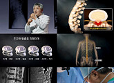 '명의' 진동규 교수가 전하는 고령 허리 질환과 허리 수술