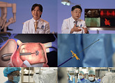 '명의' 정보영·유희태 교수가 알려주는 심방세동