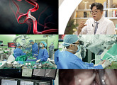 '명의' 윤원기 교수가 알려주는 뇌동맥류의 모든 것
