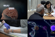 '명의' 최성혜 교수가 전하는 알츠하이머 치료 방법