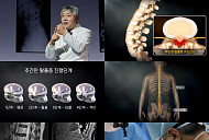'명의' 진동규 교수가 전하는 고령 허리 질환과 허리 수술