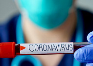 코로나19가 기저질환 환자들에게 특별히 위험한 이유