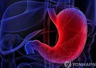 부모·형제 모두 위암이면 발병률 두 배 이상 증가
