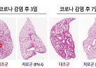 코로나·폐렴 완화하는 ‘흡입형 치료제’ 개발 길 열려