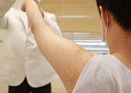 “오십견 한방 치료 효과”…어깨관절 장애 연구결과