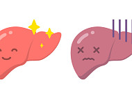 세계 첫 지방간염 치료제 탄생…美 FDA, 마드리드갈 레즈디프라 승인
