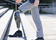 다리 절단 유학생이 개발한 로봇의족, CES 최고혁신상에 [피플]