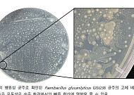 남극 빙하 속 미생물 일부에서 인체 감염 가능성 확인