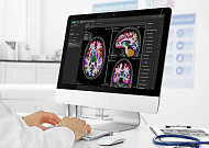 뉴로핏, 도쿄 건강장수의료센터에 ‘뉴로핏 아쿠아’ 공급