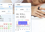 '손에 쏙!' 반지로 혈압 체크 ‘카트 비피’ 출시