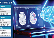AI 기반 의료기기 각축전…혁신성·해외 시장 성과 속속