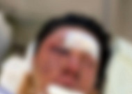 “귀에 피가 고여 안 들릴 정도”...수탉 피해 사건 직접 입 열었다