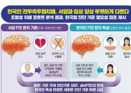 “얼굴을 못 알아보는 치매, 한국 환자 특징은 ‘충동적 언행·행동’”