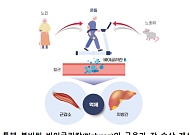 "운동하면 지방간 줄일 수 있어요"
