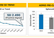 스몰인사이트 "메지온, 글로벌 임상 3상 진행…상업화 전략 차별성 부각"