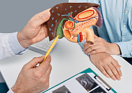 위고비·마운자로 다이어트 열풍…담석증 위험 어쩌나[e건강~쏙]