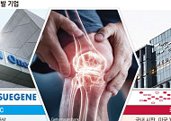 글로벌 시장 노리는 K-관절염 신약들…FDA 문턱 넘을까
