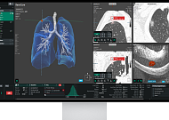 코어라인소프트, 호주 NLCSP 레퍼런스 확대⋯“구조적 성장 진입”