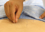 요추 협착증 한방 치료로 수술ㆍ마약성 진통제 줄어