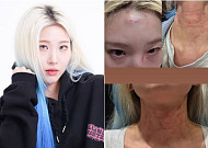 롤링쿼츠이 최현정, 행인과 시비⋯상처 사진에 소속사 측 해명