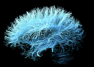 [BioS]SK바이오팜, '세노바메이트' 뇌전증 "中서 공식 출시"