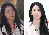 '나솔' 30기 영자, 방송 후 성형 시술 고백⋯"눈 밑 지방 재배치했다"