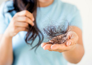 ‘고함량 비오틴’ 젤리로 진화⋯탈모 건기식도 ‘제형 혁신’