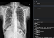 숨빗AI, 국내 1호 ‘생성형 AI 의료기기’ 식약처 허가