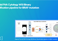 딥노이드, 갑상선 세포검사 AI 연구 성과 공개