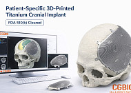 시지바이오, 환자맞춤형 티타늄 임플란트 ‘이지메이드 TI’ 美 FDA 허가
