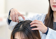 “두피 자외선도 차단” 한국콜마, ‘스칼프 선에센스’ 개발 성공