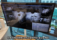 “난자 7개 준비돼 있습니다”…난자 동결 2주 프로젝트, 사실상 임신 준비 같아 [붙잡은 미래, 냉동난자 上]