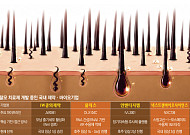 탈모도 ‘혁신신약’ 개발 열풍…주인공 누가 될까[자라나라 머리머리]