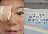 양희은, 각막이식에 이어 방사선치료도 마무리⋯"씩씩하게 견뎠다"