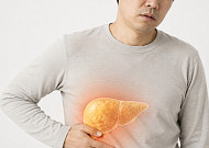 간에 쌓인 지방, 콩팥까지 위협…콩팥질환 위험 32% 높여[e건강~쏙]