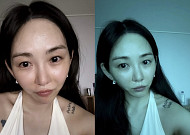 권민아, 의료사고 후 회복 근황 공개⋯팬들 응원 이어져
