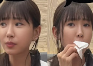 ‘성형수술 7번’ 강예원, 앞트임 복원 후 달라진 미모 눈길