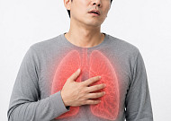 암 발생 2위 ‘폐암’…비흡연자도 방심 금물[e건강~쏙]