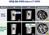 자생한방병원, 한약재 방풍의 뼈 재생 촉진 효과 최초 규명
