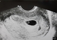 최현주·안재욱, 태명 '한방이' 뜻 공개 '이유 알고보니…' 대박!