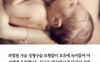 [클립뉴스] 파열된 가슴 실리콘 보형물 섞인 모유, 아기가 먹어…식약처 조사