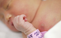 모네여성병원서 진료받은 신생아·영아 41명 잠복결핵
