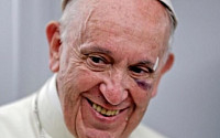 프란치스코 교황, 콜롬비아 방문 중 부상한 채 미사...베네수엘라 평화 기원