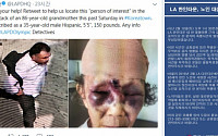 LA 한인타운 '묻지마 폭행' 피해 할머니, 양쪽눈 피멍 퉁퉁… CCTV 포착된 용의자 모습 보니