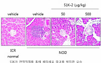 [BioS] 엔솔바이오, '제1형 당뇨병' 펩타이드 신약후보물질 발굴