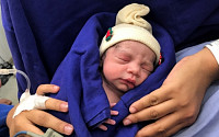 뇌사자 자궁 이식받은 여성 출산 성공…‘세계 최초’