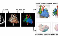 서울아산병원 '3D프린팅 활용 심장기형 수술' 첫 신의료기술 선정