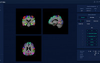 제이엘케이인스펙션, AI 뇌 노화 측정 솔루션 'ATROSCAN' 의료기기 인증